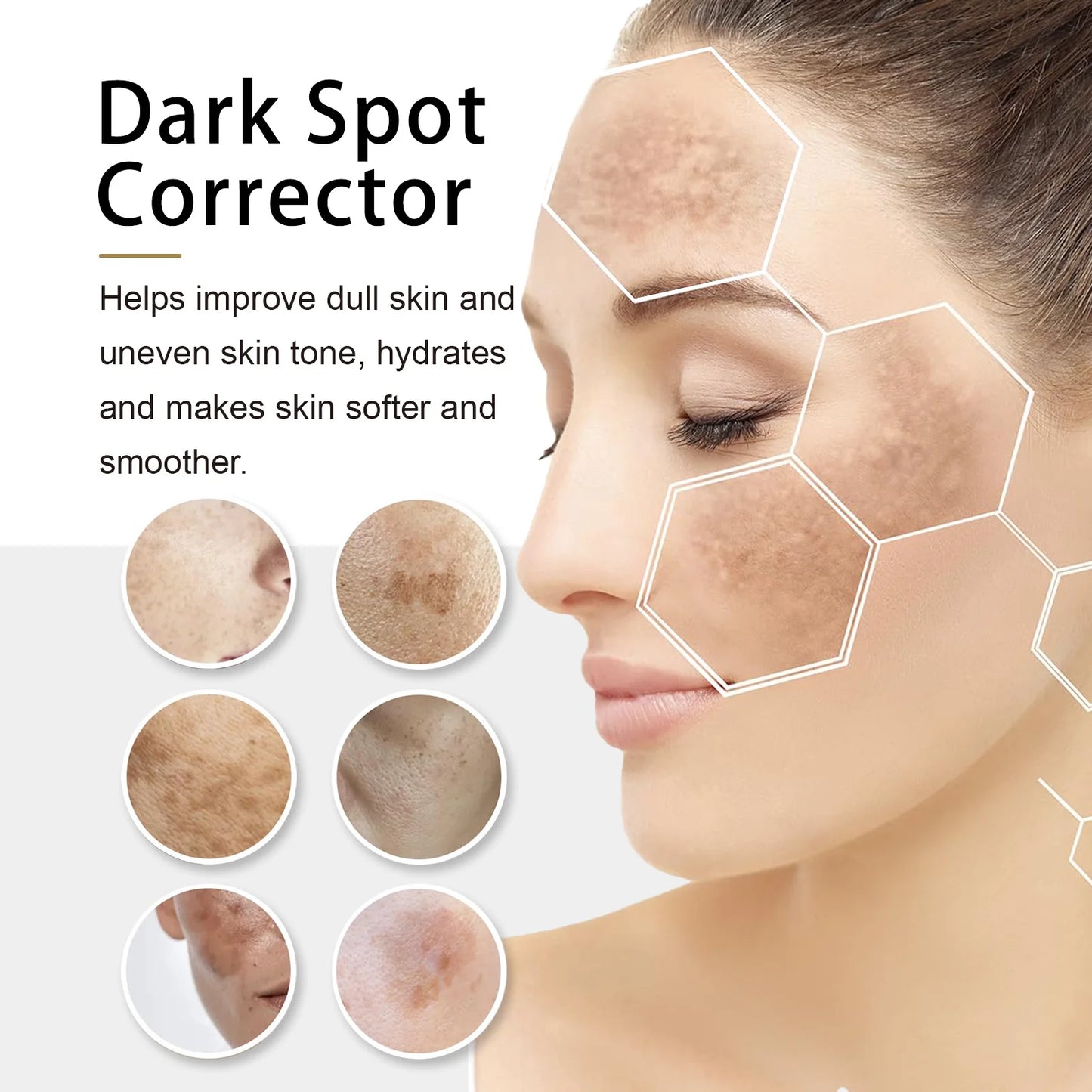 Dark spot repair cream