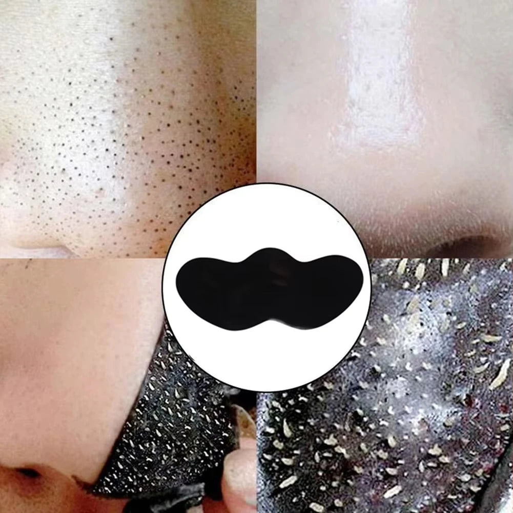 Blackhead removal stickers for the face