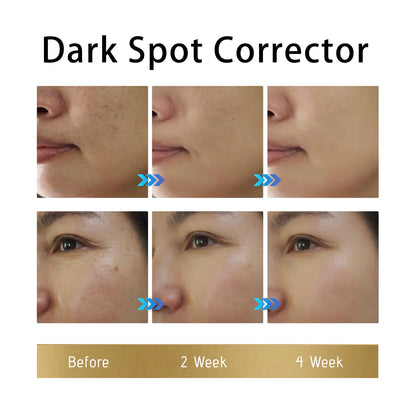 Dark spot repair cream