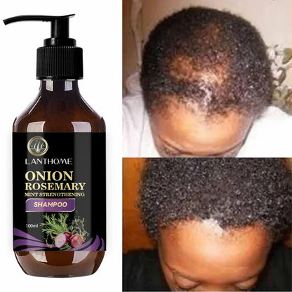 Onion and rosemary shampoo